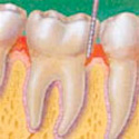 Dental Hygiene Thumbnail
